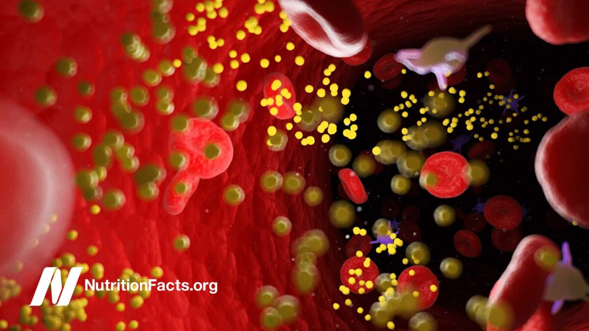 illustration of cholesterol in artery