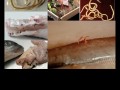 Allergenic Fish Worms