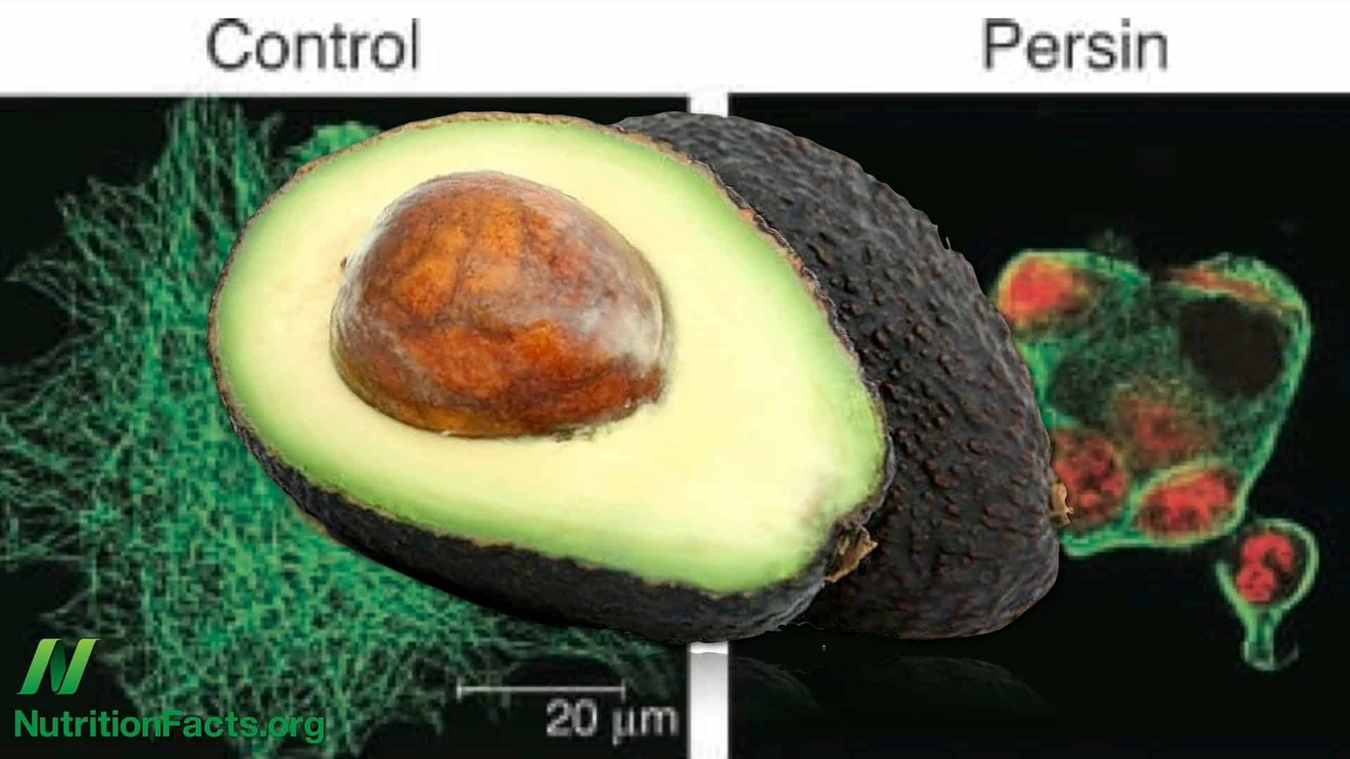 Are Avocados Good for You?