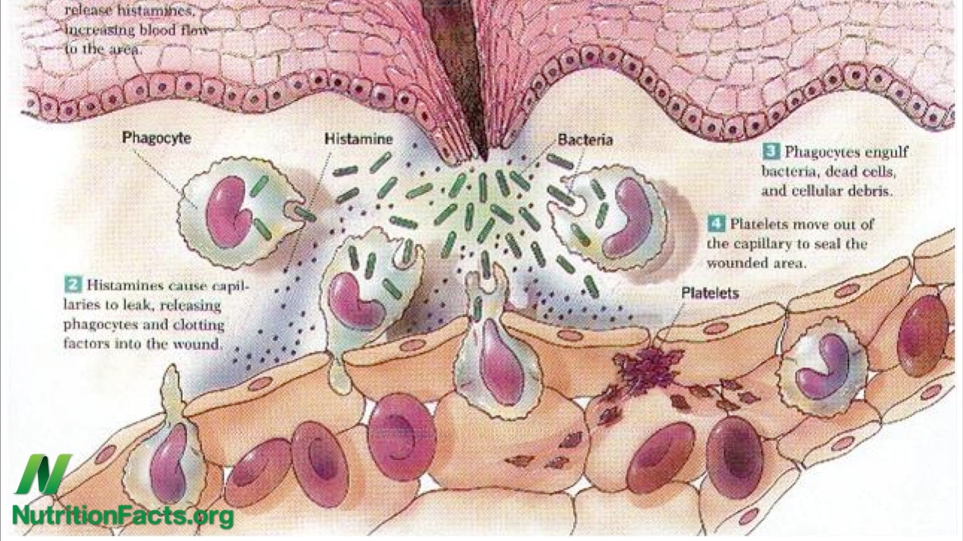 Chicken, Eggs, and Inflammation