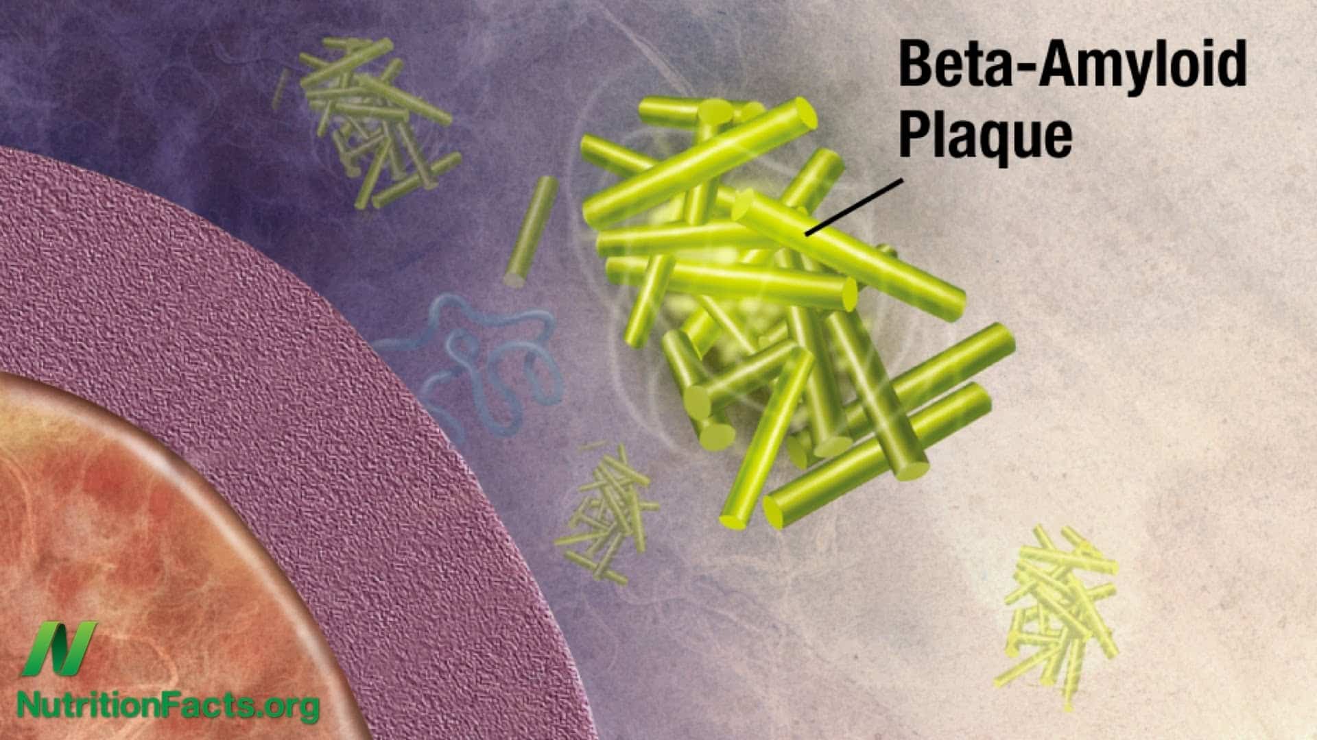 illustration of beta-amyloid plaque