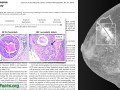 image of a mammogram