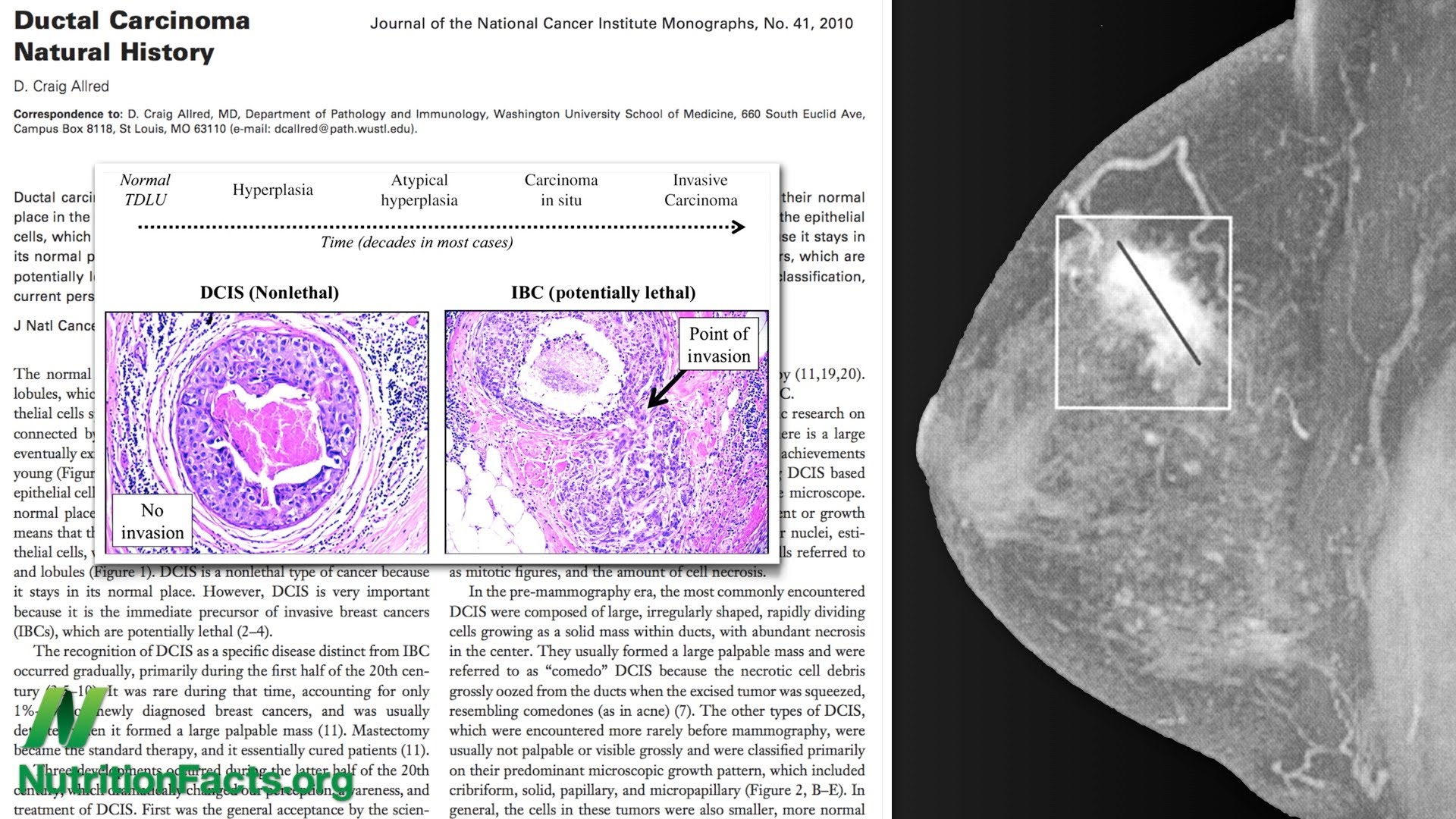 image of a mammogram