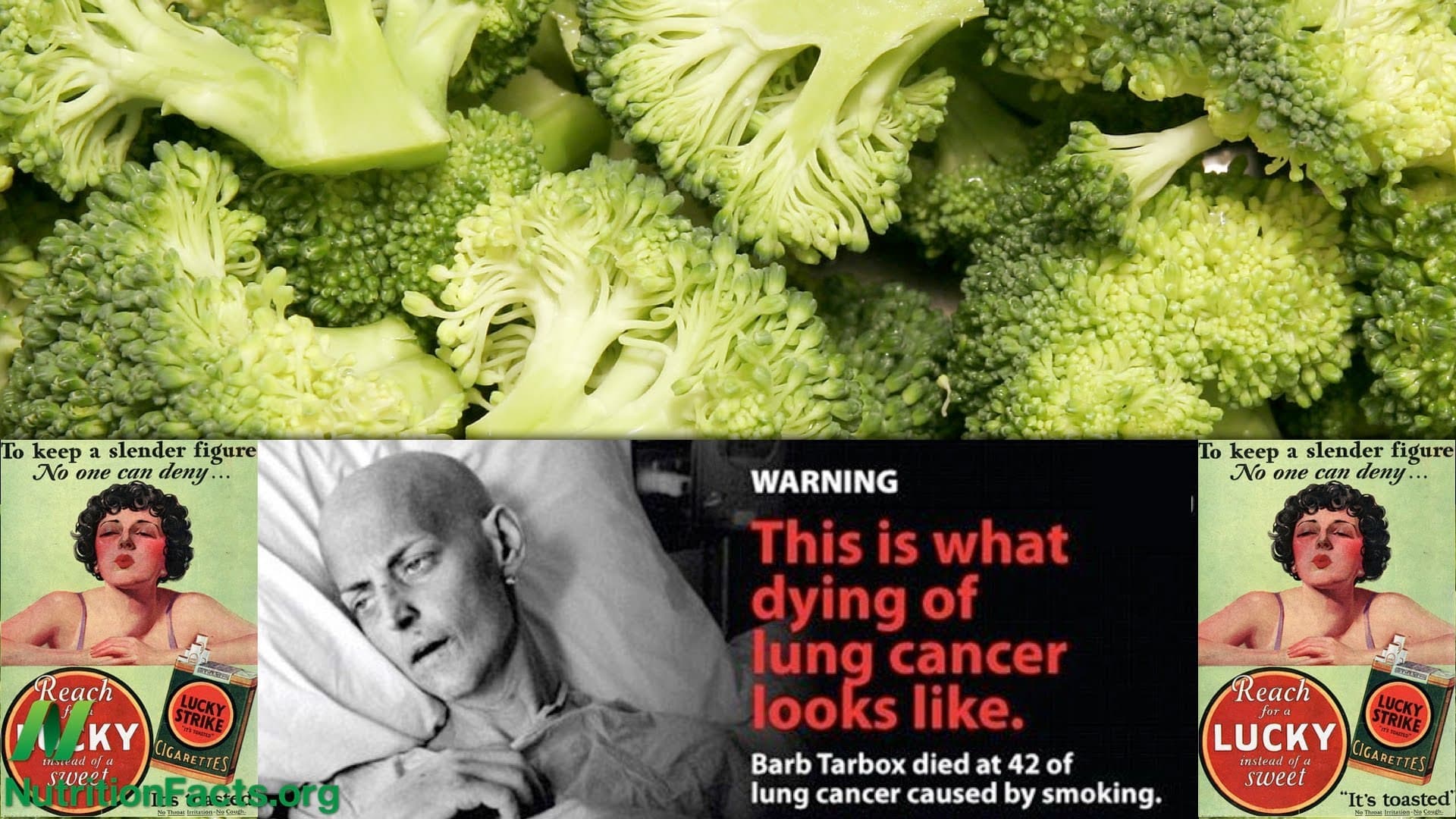 Lung Cancer Metastases and Broccoli