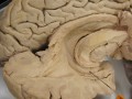 cross section of a brain