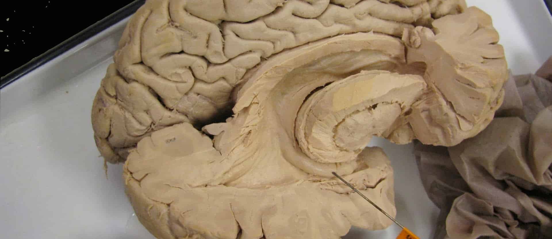 cross section of a brain