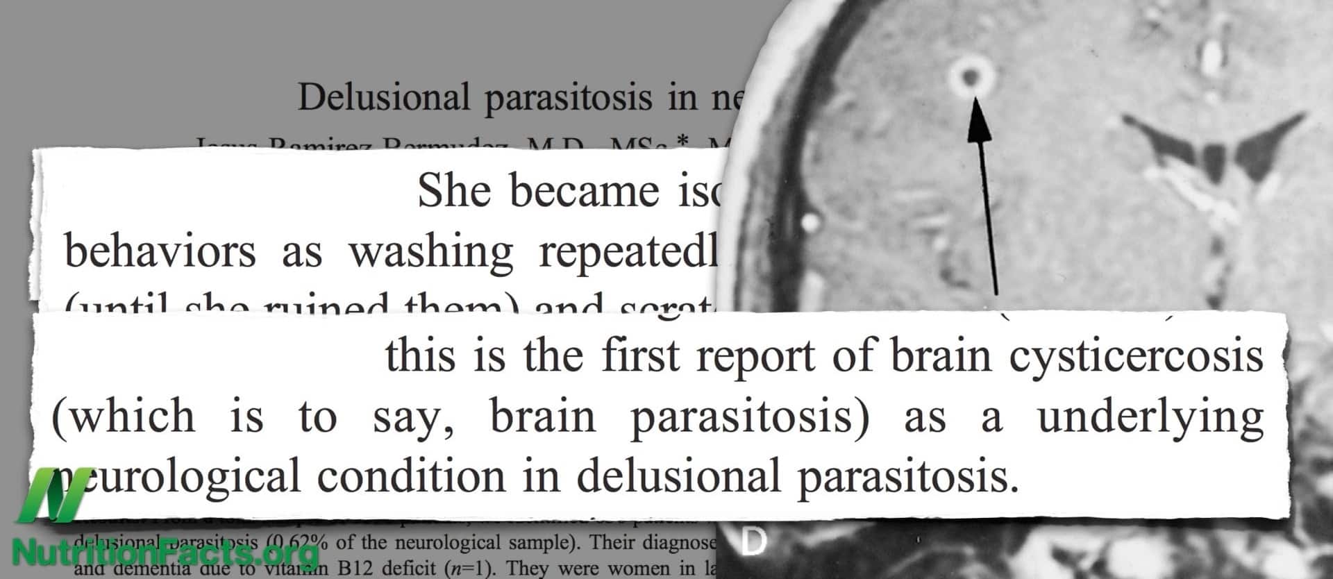 snippets of studies on brain parasitosis