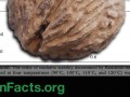 Black Versus English Walnuts