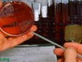 Ex Vivo Cancer Proliferation Bioassay