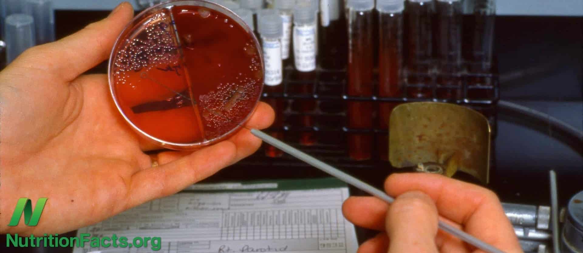Ex Vivo Cancer Proliferation Bioassay