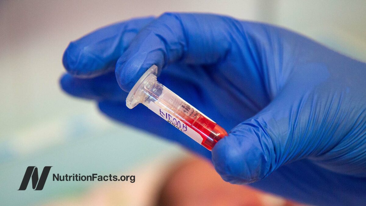 small vial of blood