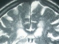 x-ray of a brain