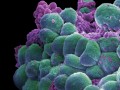 illustration of cancer cells