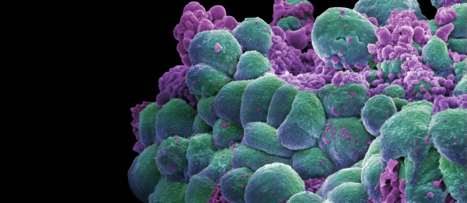 illustration of cancer cells