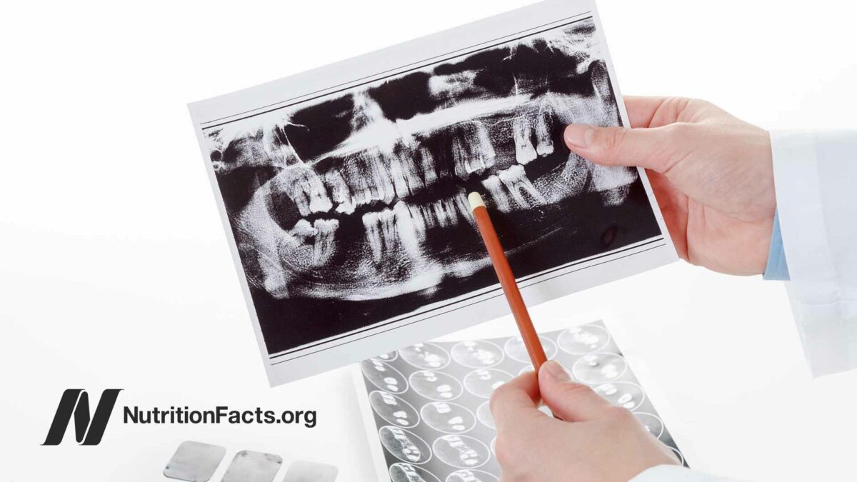 dental x-ray