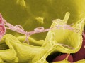 microscopic view of salmonella