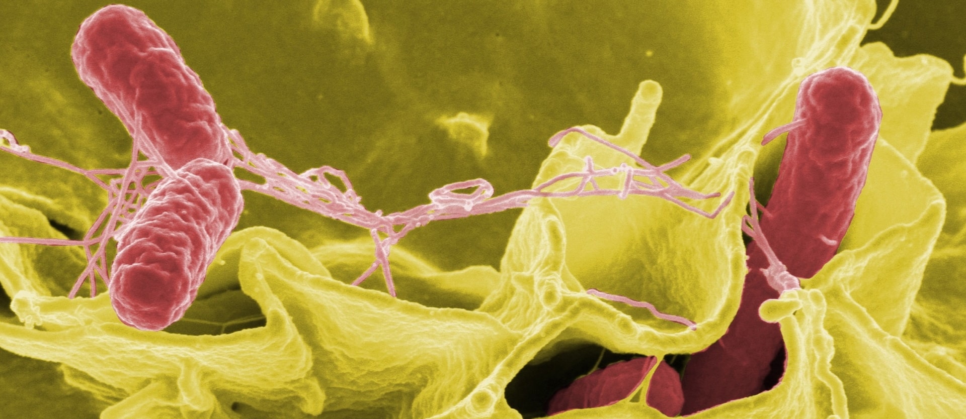 microscopic view of salmonella