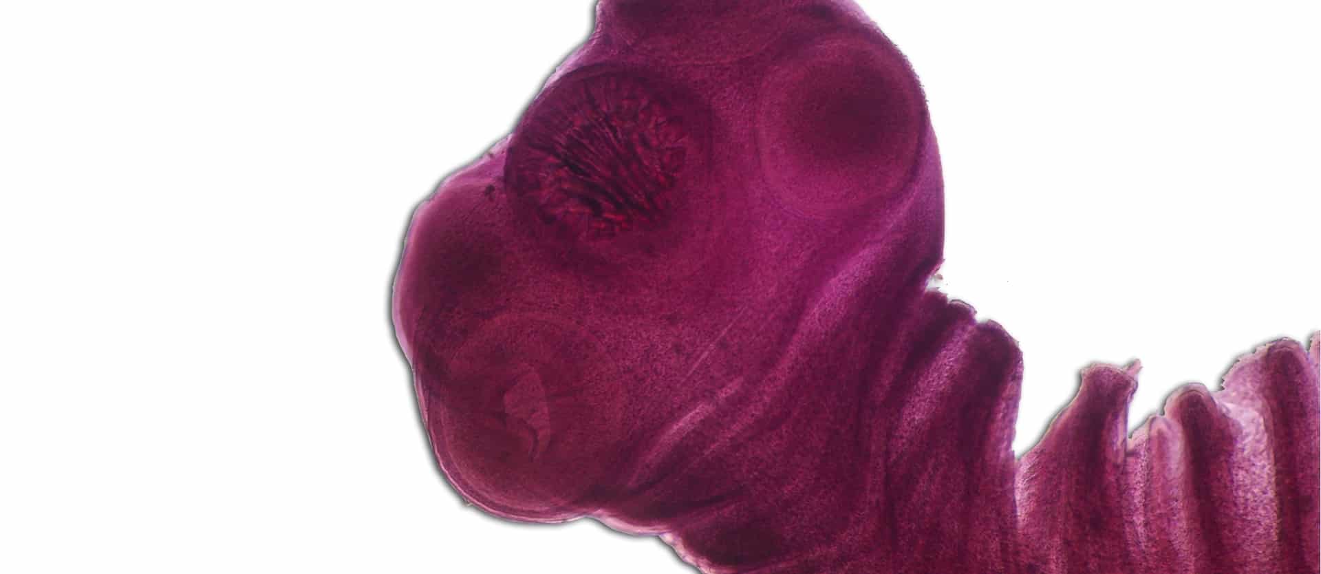 Chronic Headaches and Pork Tapeworms