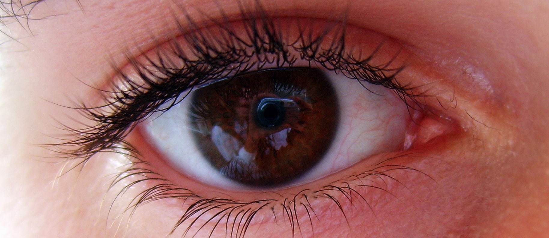 Dietary Prevention of Age-Related Macular Degeneration