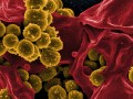 Superbugs in Conventional vs. Organic Chicken