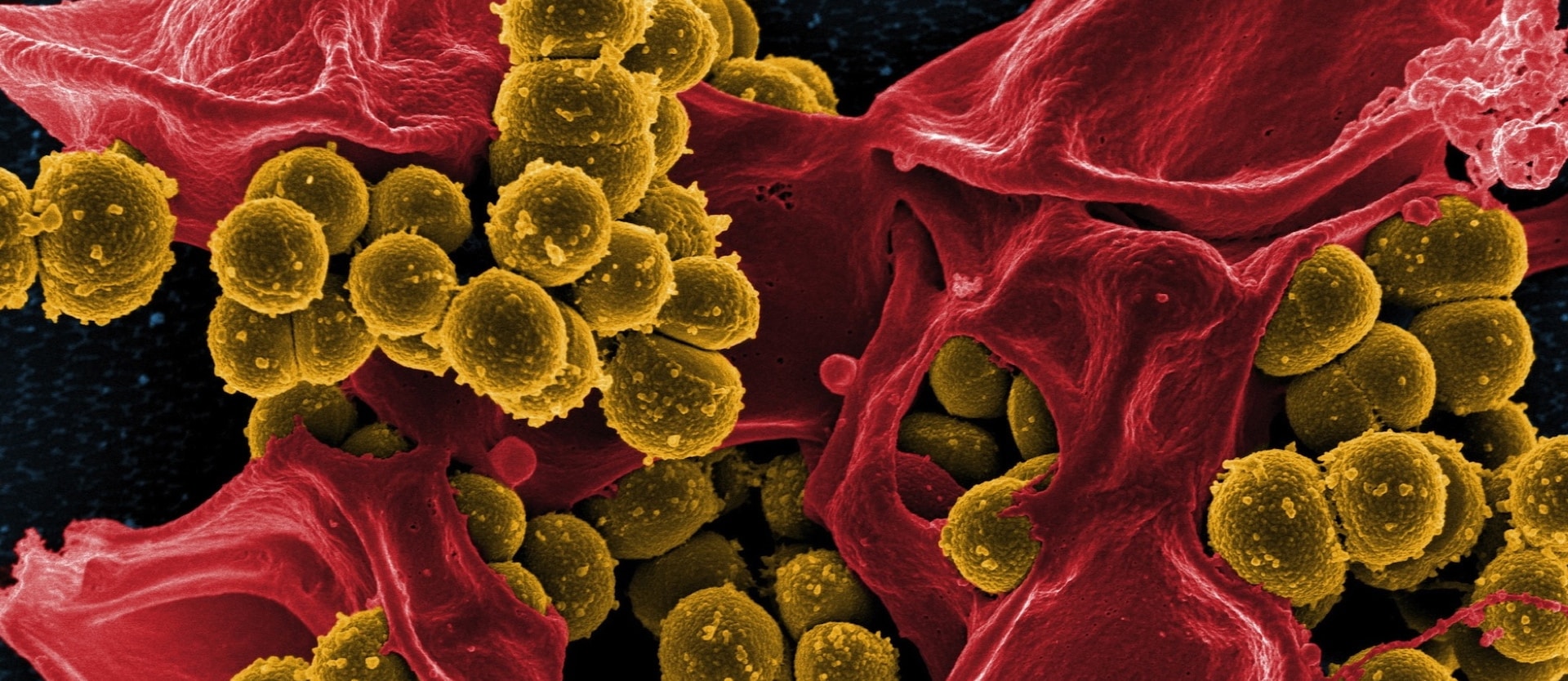 Superbugs in Conventional vs. Organic Chicken