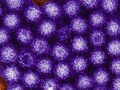 Norovirus Food Poisoning from Pesticides