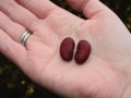 Phytates for the Treatment of Cancer