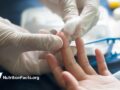 nurse pricking patient finger
