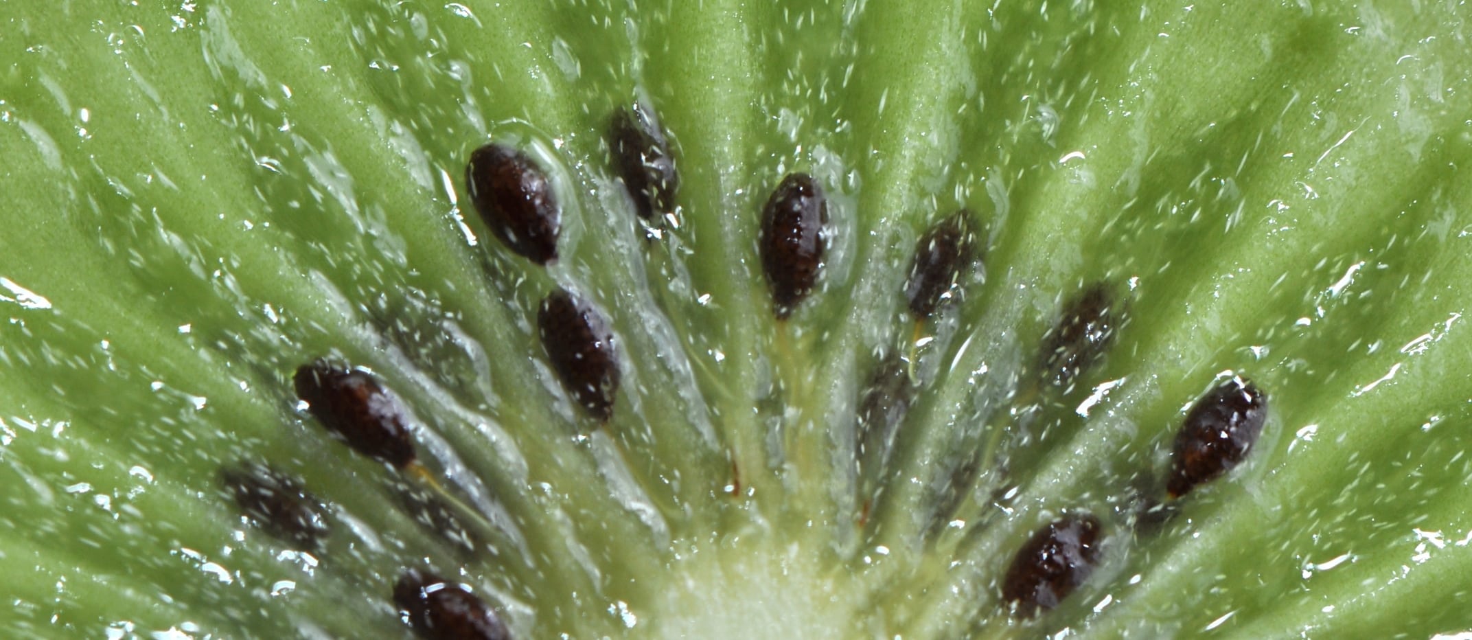 Kiwis Might Improve Your Sleep!