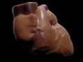 Dark Chocolate and Artery Function