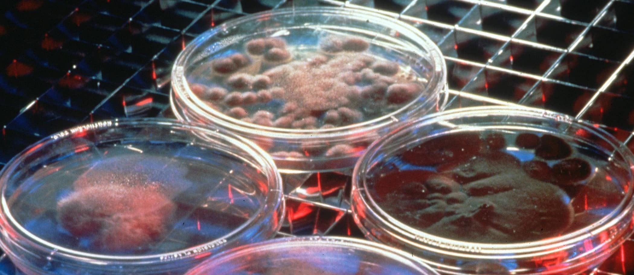 A Low Methionine Diet May Help Starve Cancer Cells