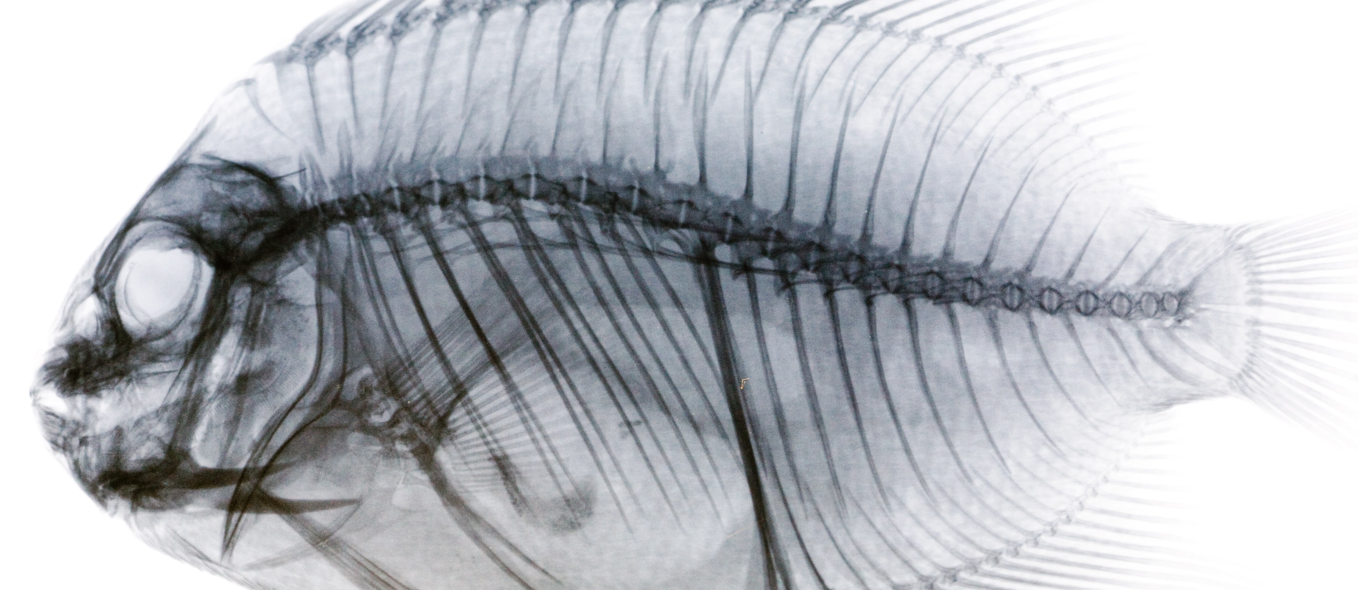 The Scary Reason Why Pregnant Women Should Avoid Fish
