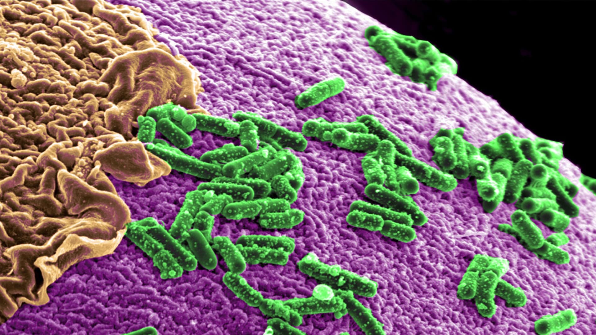 Preventing Ulcerative Colitis with
