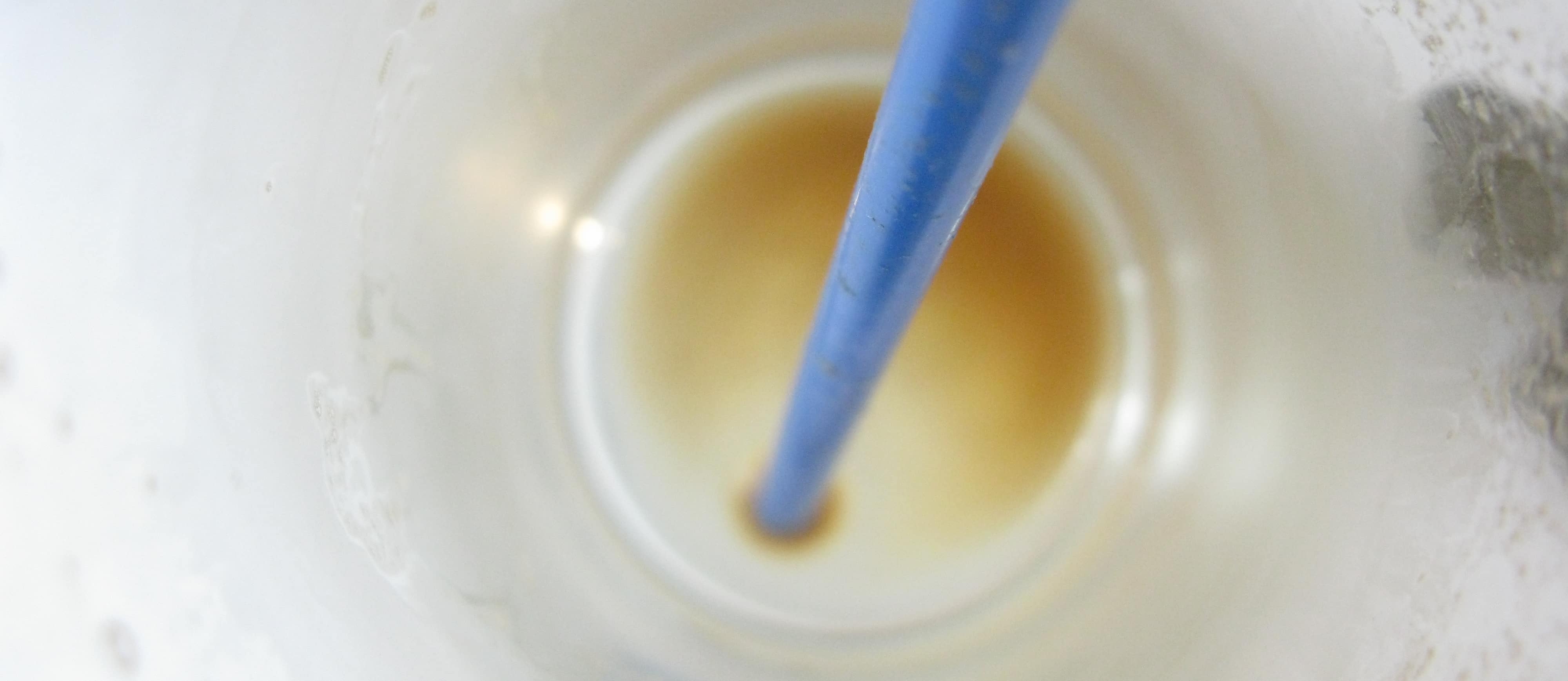 The Link Between Milk and Prostate Cancer