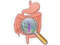 Bowel Wars: Hydrogen Sulfide vs. Butyrate