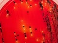 Treating Ulcerative Colitis with Diet