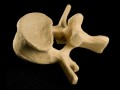 Almendras para la osteoporosis