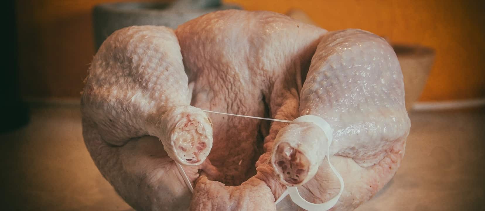 Infectobesity Adenovirus 36 and Childhood Obesity
