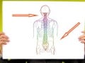 Prunes for Osteoporosis