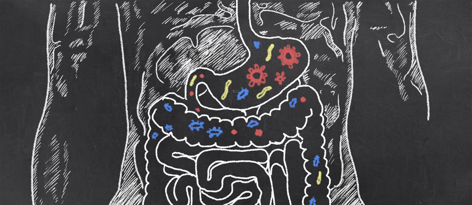 Preventing Ulcerative Colitis with Diet