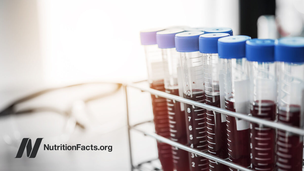 vials of blood