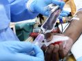 Donating Blood to Prevent Heart Disease