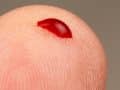 close-up of a finger tip with a drop of blood on it