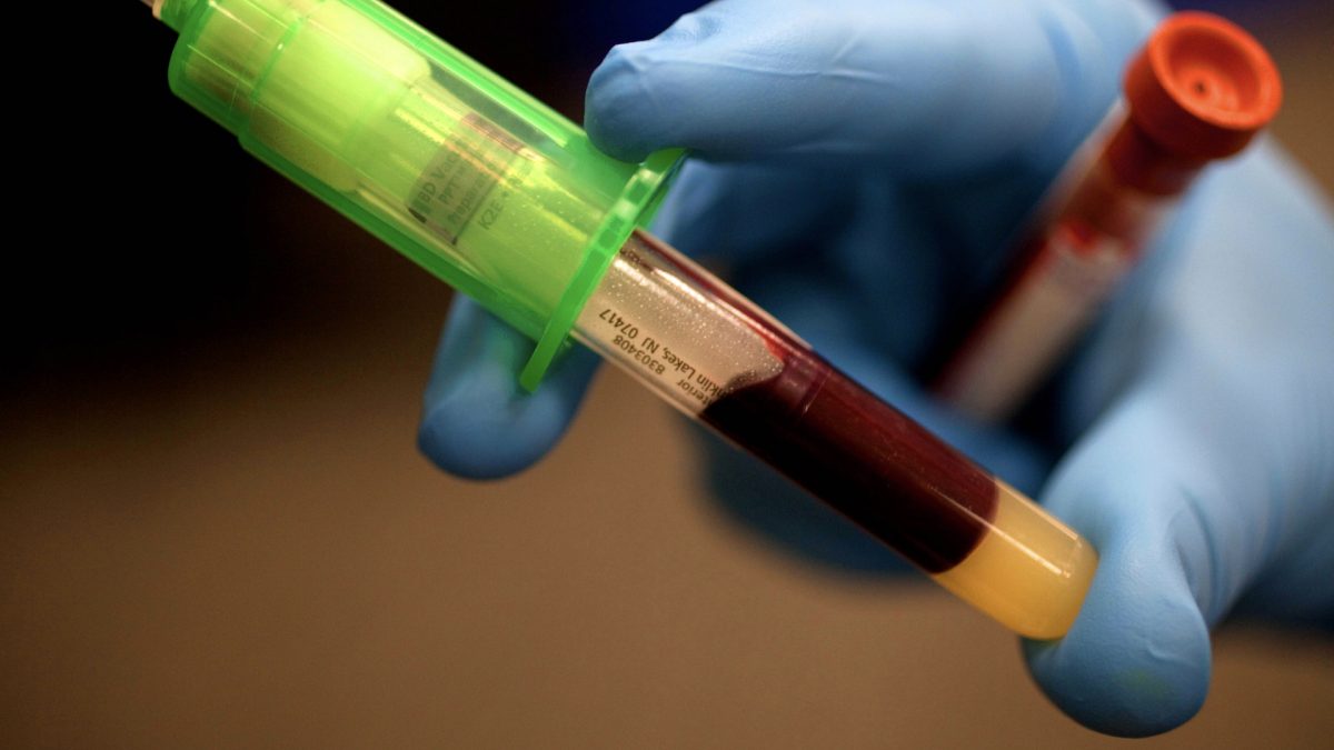 gloved hand holding two vials of blood