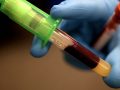 gloved hand holding two vials of blood