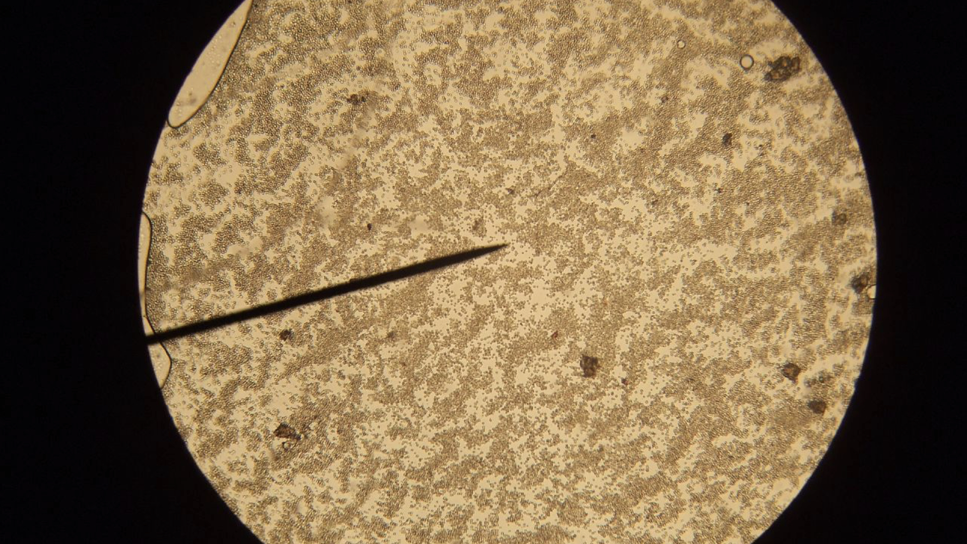 Candida In Poop Candida In Stool Candida Stool Candida Die Off Stool Yeast