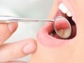 Oil Pulling Benefits for Plaque and Gingivitis