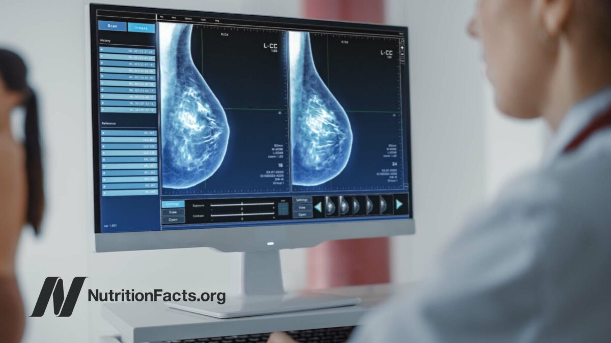 doctor looking at mammogram image on computer