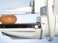 Do Mammograms Hurt?