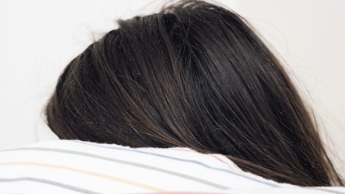 hair with dandruff